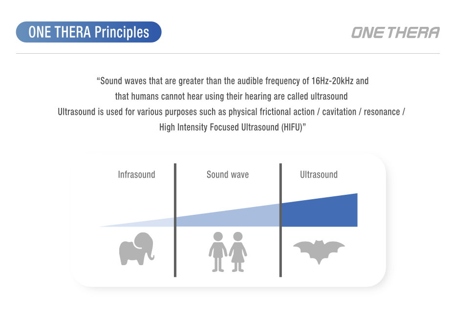Long Pulsed HIFU Lifting