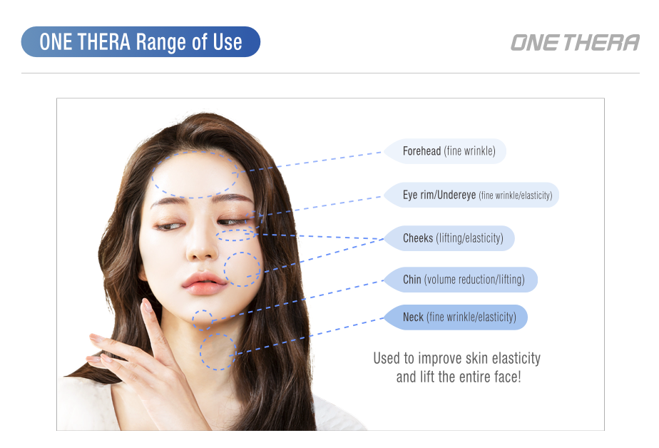 Long Pulsed HIFU Lifting